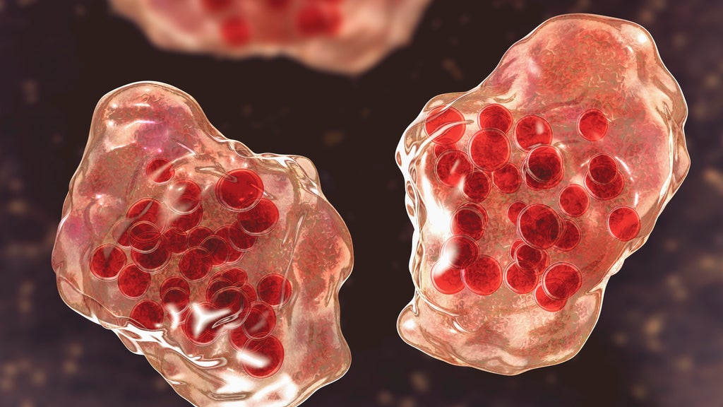 Central Minnesota county reports "several cases of suspected measles" — WCCO / CBS Minnesota, Shoreview Health news